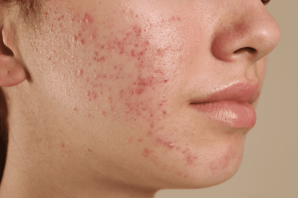 Image Credit Shutterstock 72