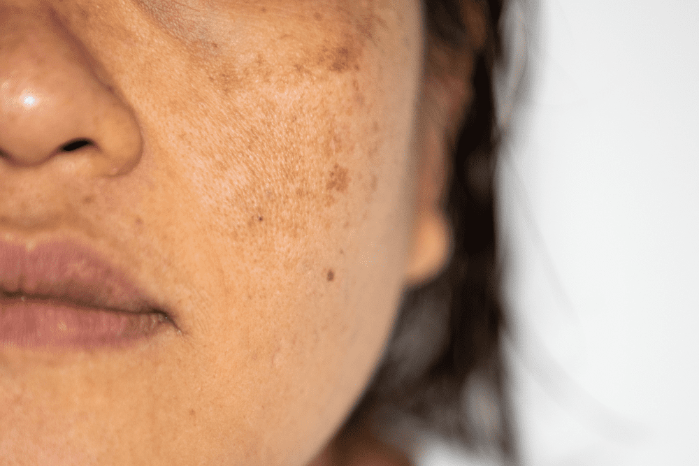 Image Credit Shutterstock 76