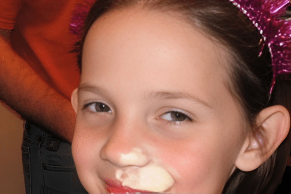 Canadians Get Their Noses Greased for Good Luck